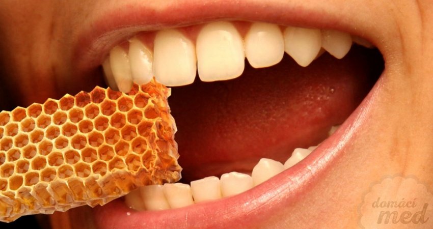 Propolis a parodontóza